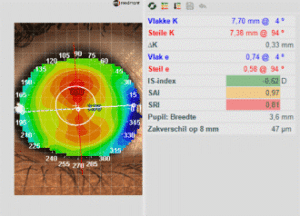 UCO contactlenzen